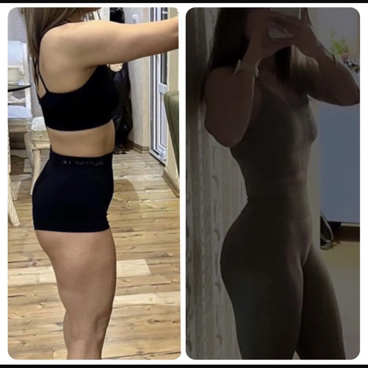 Side-by-side client transformation photographs shown from a profile angle.